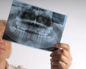 roentgen of teeth