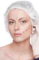 Correction lines on woman face, before surgery operetion