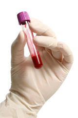 Blood container in hand with glove