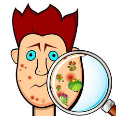 Teenager boy with acne