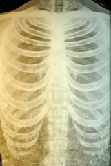 Human Chest X-Ray