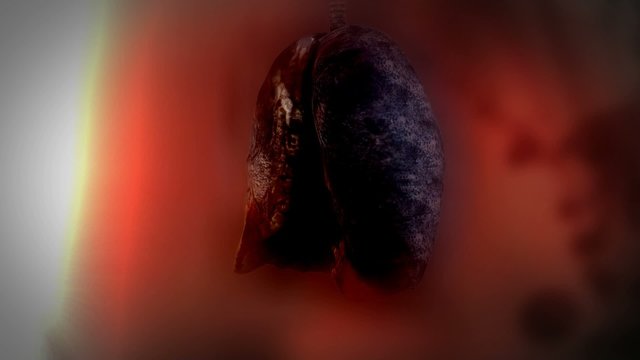 Healthy and cancer lungs . Loopable