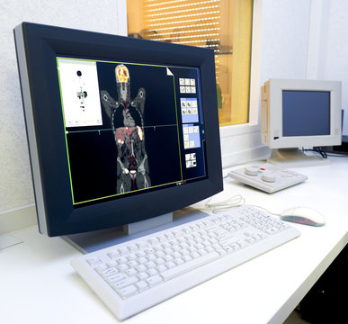 monitor with an image made with the  PET/IC scan