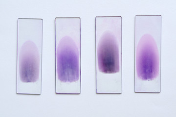 Blood film