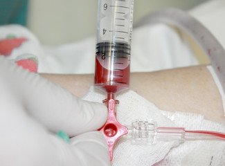 take on the analysis of samples of arterial blood