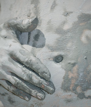 Mud therapy