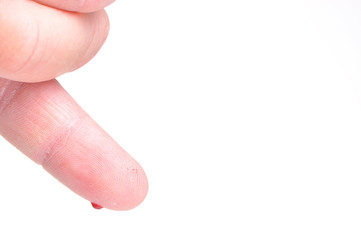 blood dripping from pricked finger isolated