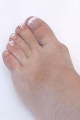 ricostruzione unghie piede