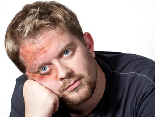 Große Verletzung im Gesicht eines Mannes
