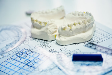 orthodontic molds