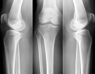 X-ray
