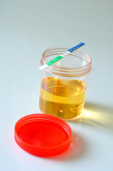 Urine analysis