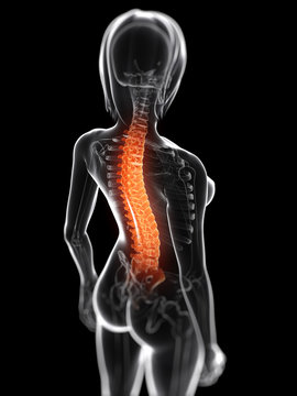 3d rendered medical illustration - painful back