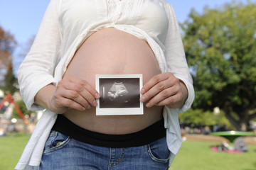 pregnancy: couple holding ultrasonic image of baby