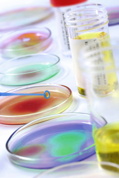 Sant&eacute; - Analyse d'urine
