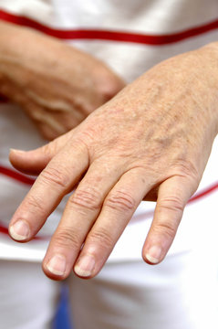 femme douleur rhumatisme