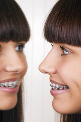 Girl with braces reflected in mirror