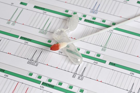 DNA Profil - genetischer Fingerabdruck