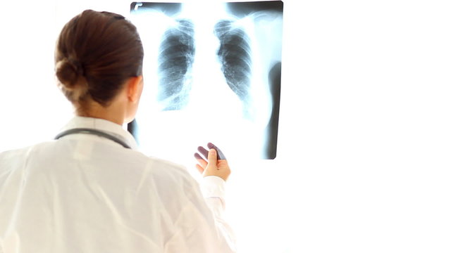 Female doctor looking at xray of human lungs, isolated