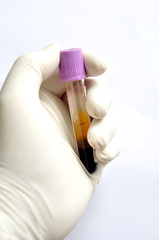 Blood sample