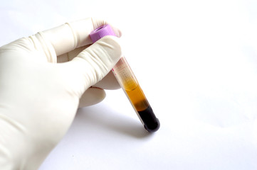 Blood sample