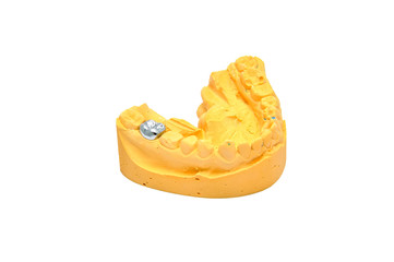 dental mould