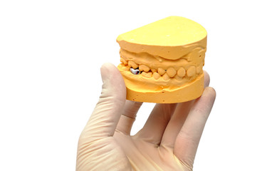 dental mould and hand