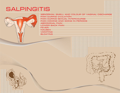 Salpingitis background