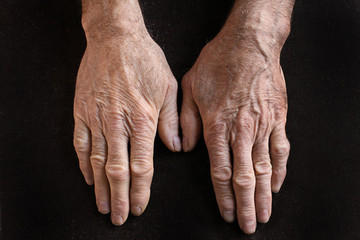 old hands