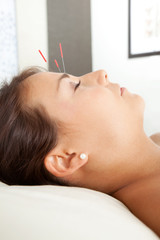 Facial Acupuncture