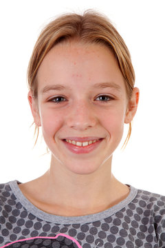 Portait of teenage girl with pimpels
