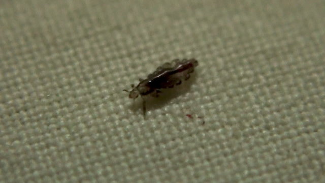 human head lice (macro shot)