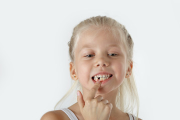 Little girl with missing front teeth