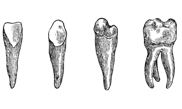 Dents