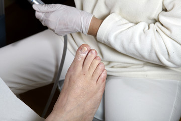 Fototapeta na wymiar Medizinische Fußpflege - Foot care - Chiropody