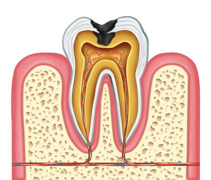 Tooth inner anatomy of a cavity