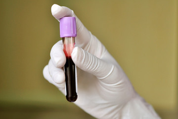 Blood sample