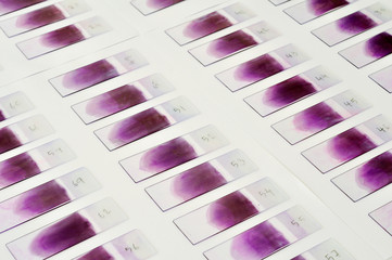 Blood film