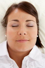 Facial Beauty Acupuncture Treatment