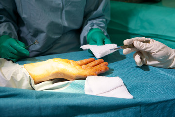 Surgeon and nurse performing hand operation