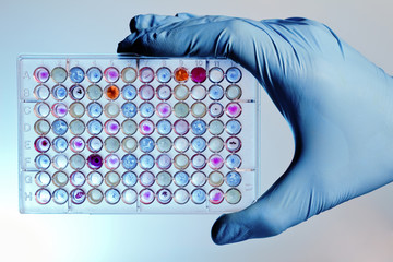 Hand with a microplate