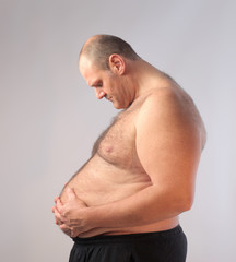 Overweight