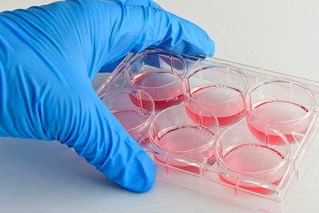 Scientist handling 6-well plate in cell culture experiment