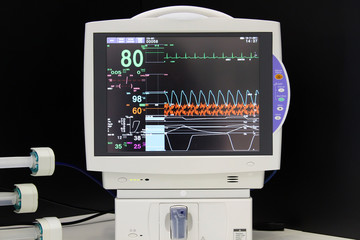 ECG monitor