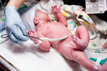 Newborn cute infant baby with umbilical cord - obrazy, fototapety, plakaty