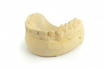 Teeth gypsum model