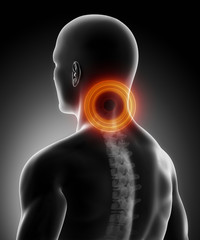 Pain in cervical spine