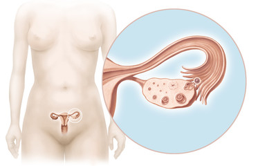 Uterus, Ovarien und Eisprung - obrazy, fototapety, plakaty
