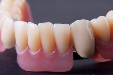 dental wax model