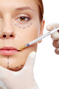 Injection of collagen